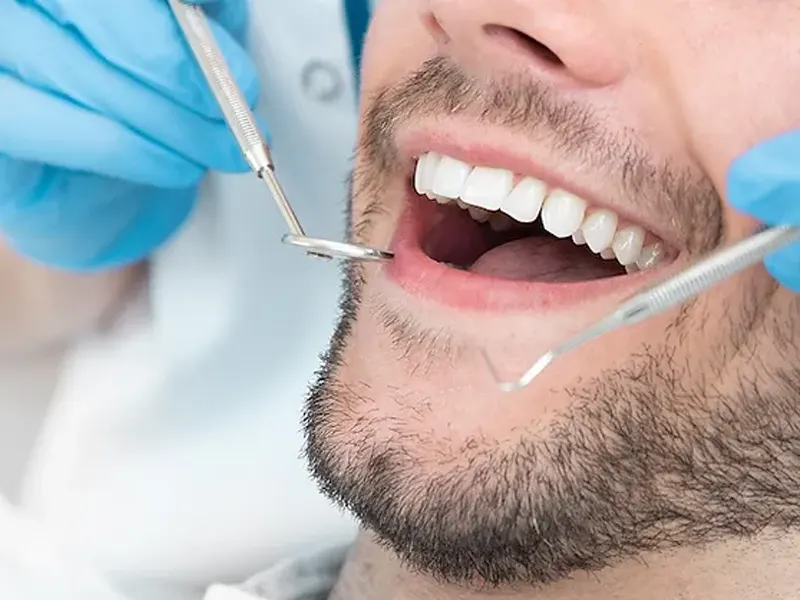 دندانپزشکی-بعد-از-عمل-بینی